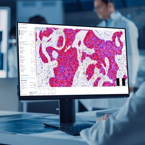 Disrupting the pathology playbook with AI; INITIATE with BUY